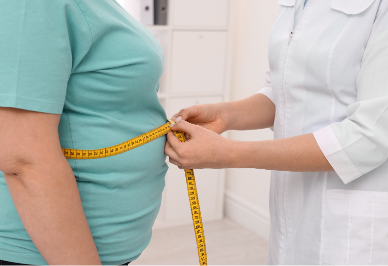 Obesity Management